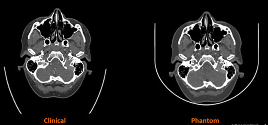 Comparison between a computer tomography and a 3D-printed phantom.