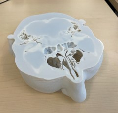3D-printed phantom head slice. Courtesy of Business Wire