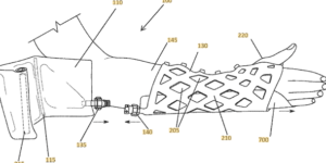 Resin Cast Patent