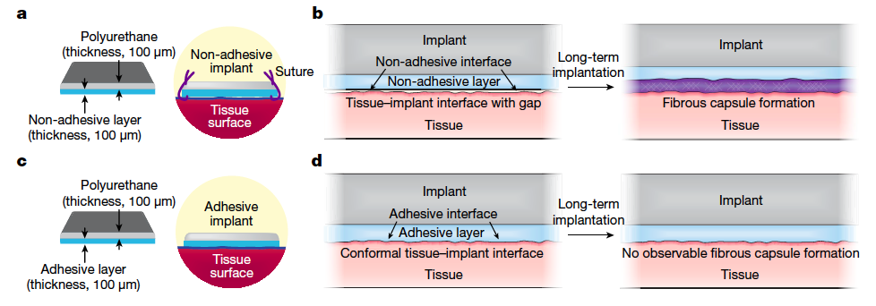Adhesive Hydrogel Prevents Scar Tissue Formation in Medical Implants ...