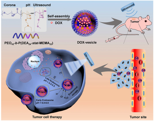 Schematic illustration of ultrasound-sensitive targeted Doxorubicin drug delivery in tumor cells. Copyright © 2020, ELSEVIER Publishing Group. Courtesy of Smart/stimuli-responsive hydrogels: Cutting-edge platforms for tissue engineering and other biomedical applications.