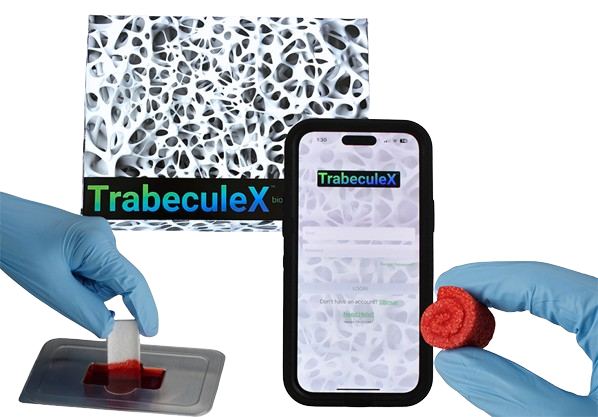 TrabeculeX Continuum. Courtesy of Xenco Medical.